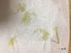 顺产后有绿色分泌物