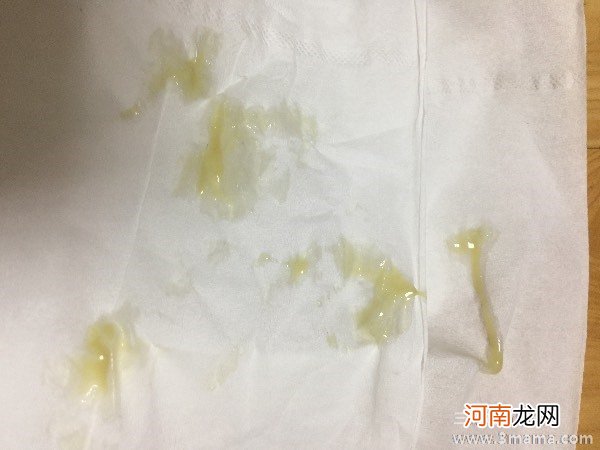 顺产后有绿色分泌物