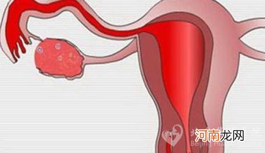 吃通输卵管中药的反应
