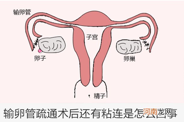 怎么通输卵管视频