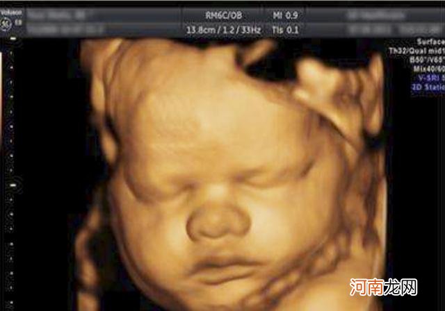 四维照片一看就是男孩 四维彩超怎么看胎儿是男是女呢