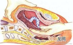 脐带在胎盘边缘能顺产吗