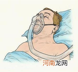 睡眠呼吸暂停中药