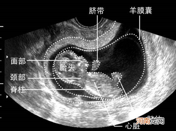 脊柱串珠是女宝,平行排列是男宝 真的非常准！