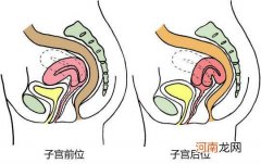 子宫后位怎么办啊调整