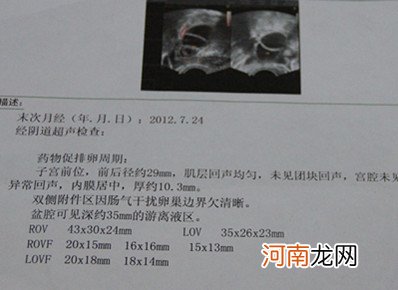 做b超看排卵的最佳时间