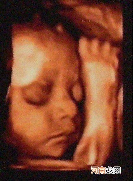 怀孕24周胎儿高清图