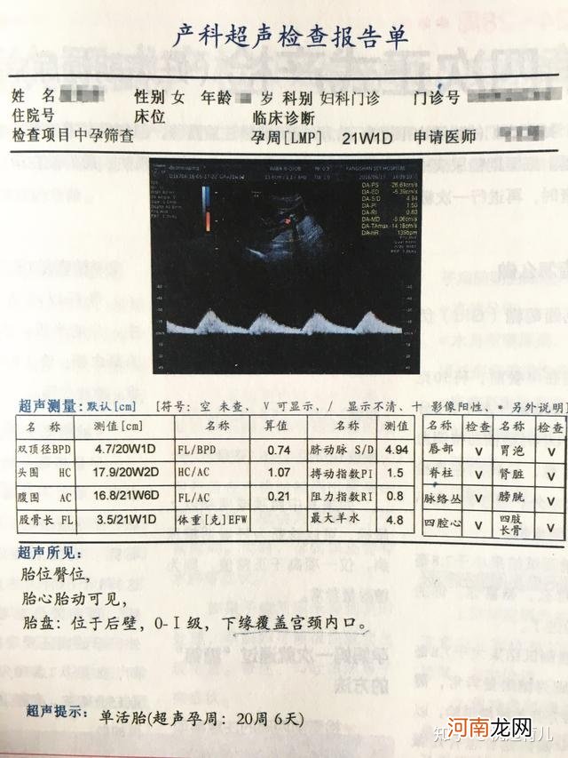 怀孕23周头围多少正常