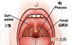 慢性咽喉炎最佳治疗方法