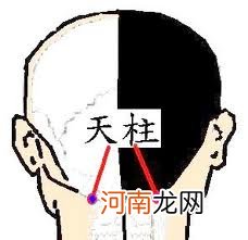 天柱穴针灸手法