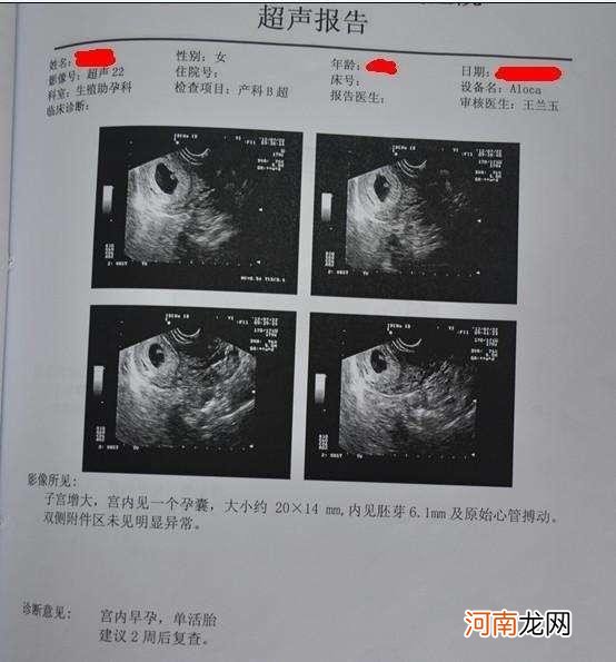 孕妈一分钟学会看B超单 b超数据看胎儿性别