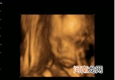 24周胎儿生殖图片