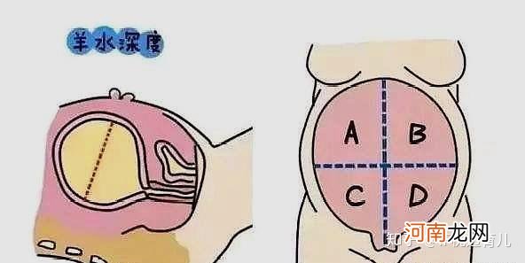 孕24周羊水暗区正常值