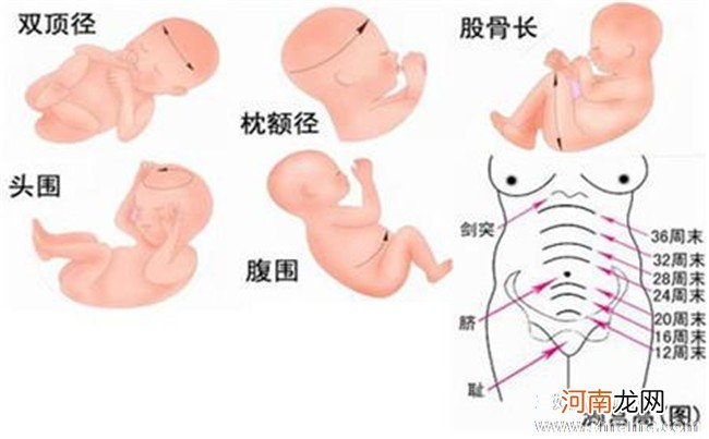 孕晚期胎儿腹围偏大