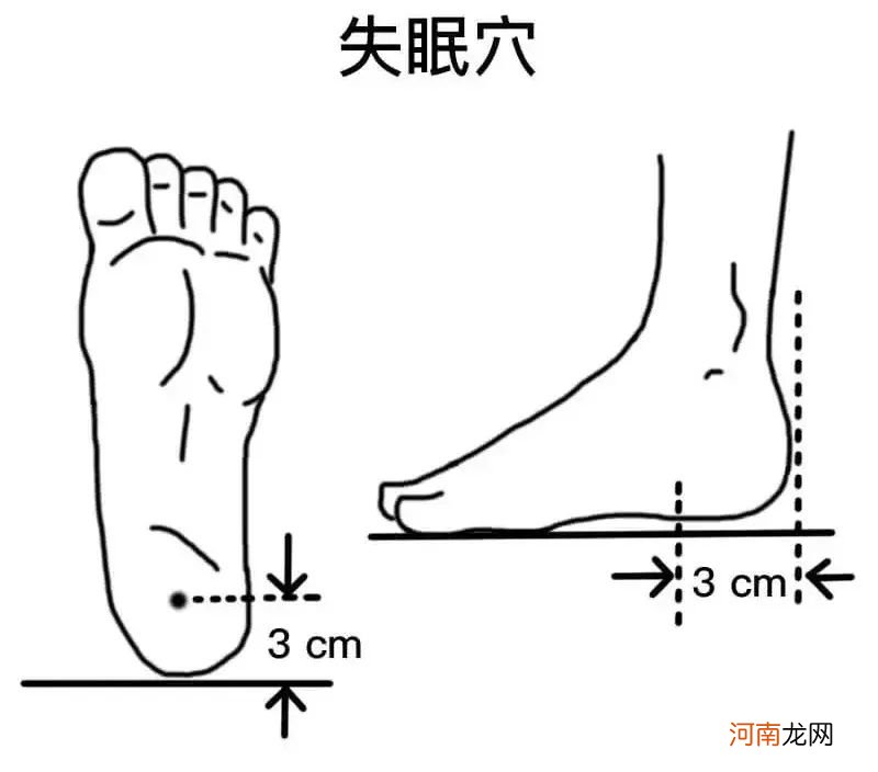 足底穴位按摩治疗失眠