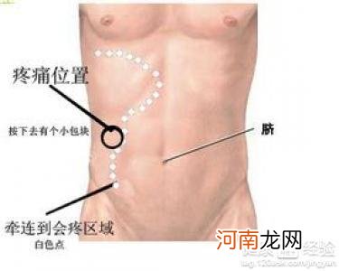 腹部下方左边疼痛怎么回事