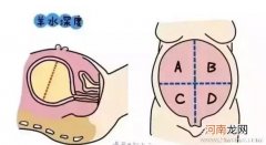 怀孕月份越大羊水越少