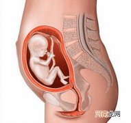 孕27周臀位的胎儿图
