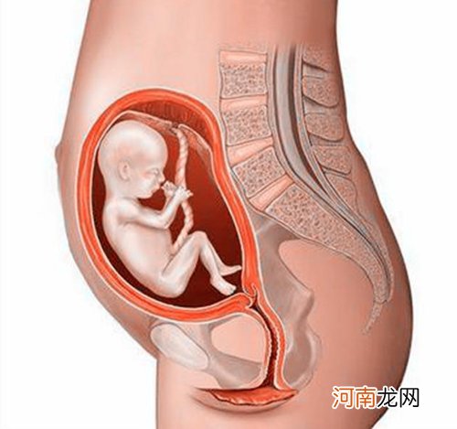 孕27周臀位的胎儿图