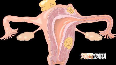 伤害最小的流产方式 无痛人流多少天做最佳时间