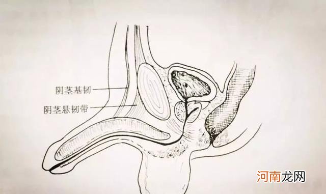 丁丁变形记-延长/增粗术” 男人加长加粗