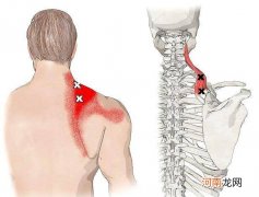 肩胛骨疼痛是怎么回事