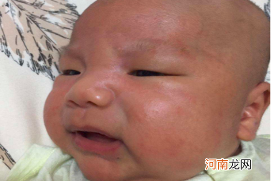 新生儿脸上有小红点用什么药麻麻有妙招，看完秒懂！