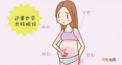 产后祛除妊娠纹的方法 坐月子怎么消除妊娠纹