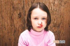 儿童白血病流鼻血特点 其实与普通流鼻血有区别