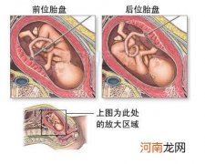 分娩后第一天产妇特别要注意什么