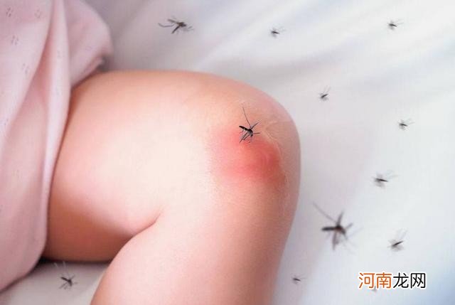 5个防蚊小妙招 有效防止蚊虫叮咬的方法