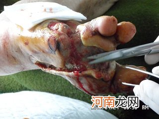 糖尿病坏疽治疗方案