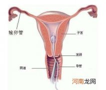 产后过度瘦身可致子宫下垂