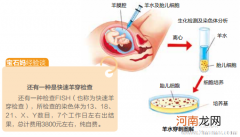 做羊水穿刺多久出结果