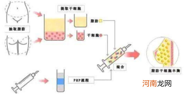 细胞激活术填充