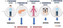 多样化的糖尿病怎么治