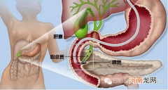 肝胆湿热可惜喝艾草水吗