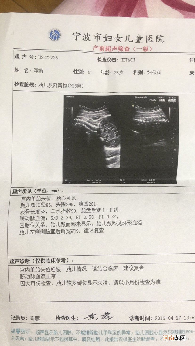 正常28周胎儿双顶径是多少正常值