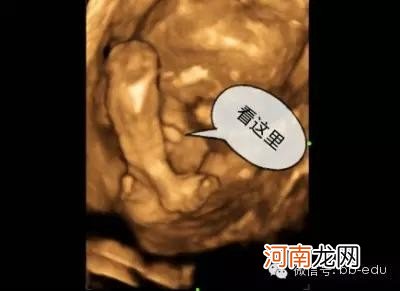 怀孕4个月照的彩超 彩超4个月男胎儿彩超图片
