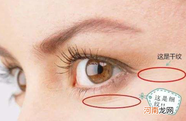 眼周细纹和干纹的区别
