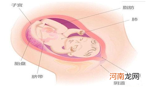 怎么能让五个月能死胎