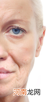 30岁皮肤松弛下垂怎么办