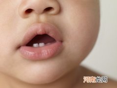 出牙晚的孩子是发育不正常吗