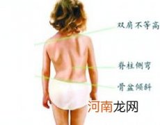 五岁前预防脊柱侧弯多摸摸孩子的背