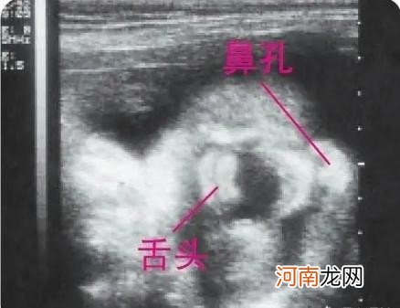 怀孕1-9个月胎儿的样子 怀孕八个月胎儿彩超图