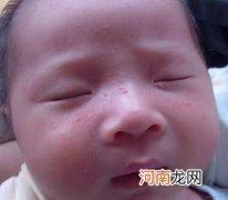 宝宝脸上有奶癣怎么食疗