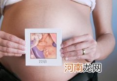 孕妇妊娠线能看胎儿性别
