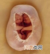 胎儿的性格形成 跟母亲的心理状态有关
