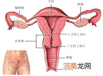 关于卵巢巧克力样囊肿的