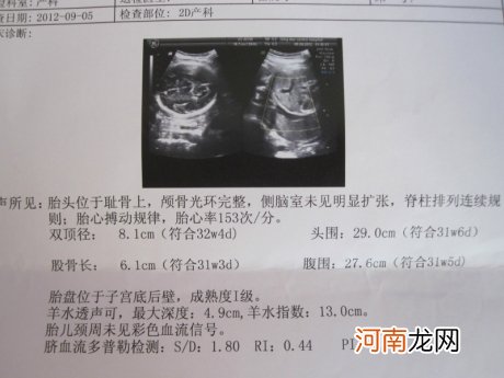 孕后第一次正式产检是何时